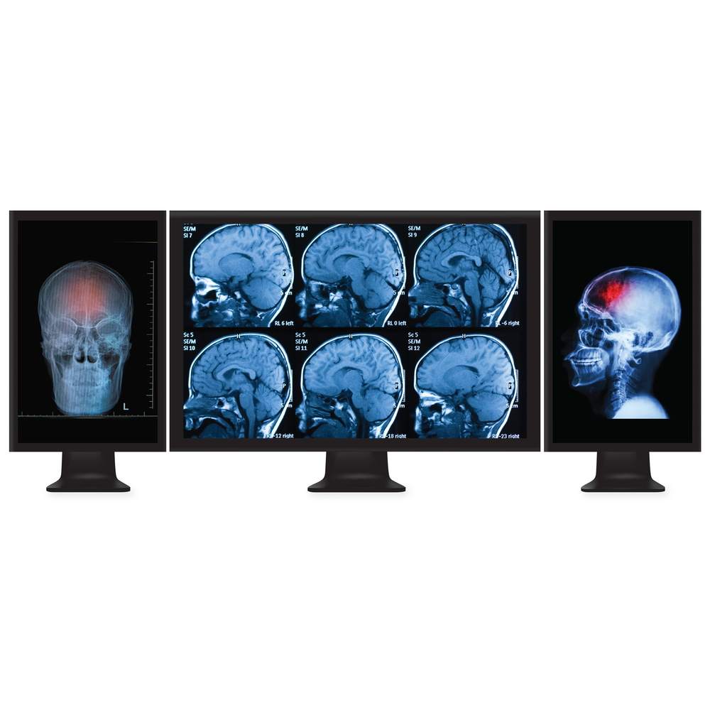 InfiniteFix Product Image